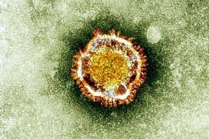 Zika Virus 11