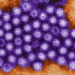 Norovirus 2