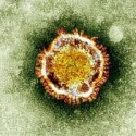 Two New Zika Cases in North Texas